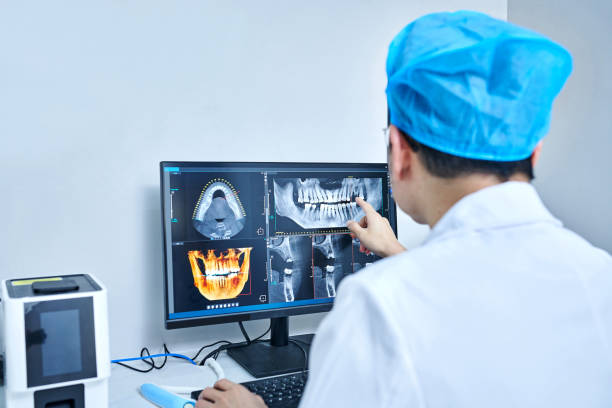 Best Emergency Wisdom Teeth Removal in Rossmoyne, OH